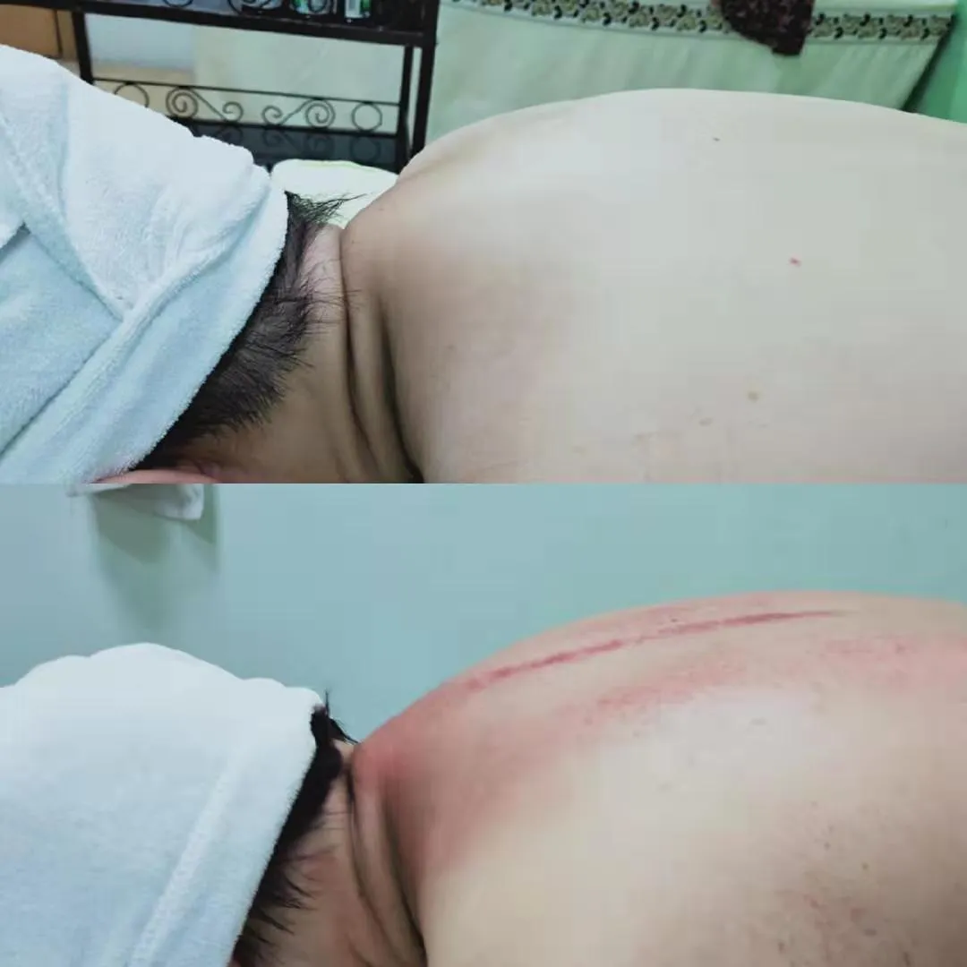 睡不醒?水肿?三招教你制胜(图8) 睡不醒?水肿?三招教你制胜(图8)